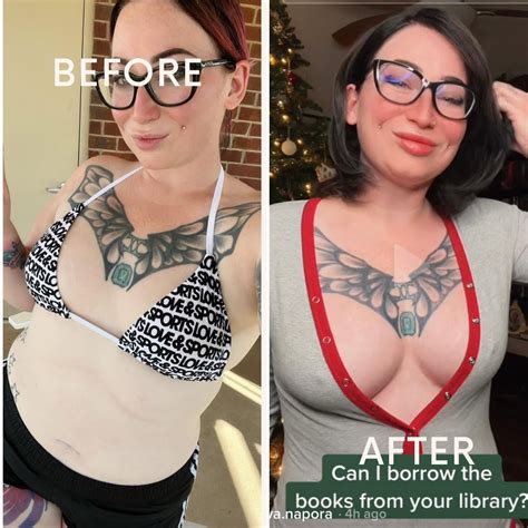 Fat Transfer to Breast, 6 week post op : r/PlasticSurgery