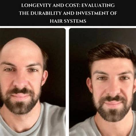 Decoding Hair Replacement Systems: Effectiveness and Options | Clinikally