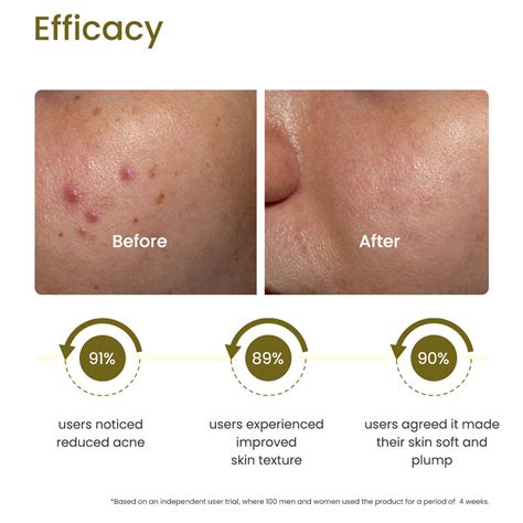 Snail Mucin Renew Overnight Face Gel, 50ml