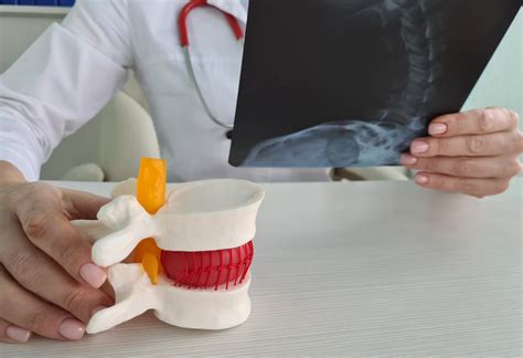 Image result for Disc Replacement Procedure