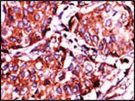 phospho-INSR-Y1361 antibody Immunohistochemistry, ELISA SAB1300309 Anti-IR