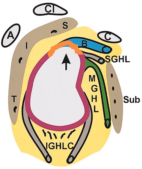 Superior Labral Anteroposterior Tear: Classification and Diagnosis on ...