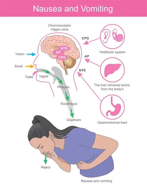 Nausea And Vomiting Pathophysiology
