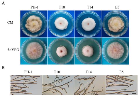 A Gin4-Like Protein Kinase GIL1 Involvement in Hyphal Growth, Asexual ...