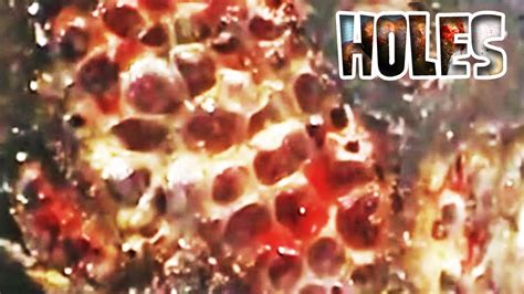 Jigger Fleas Remove 的图像结果