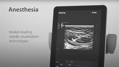 Image result for Mindray Te7 Measurements Tutorial