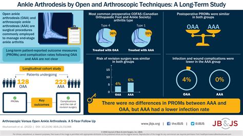 Ankle Fusion Techniques Continue to Evolve - OrthoBuzz