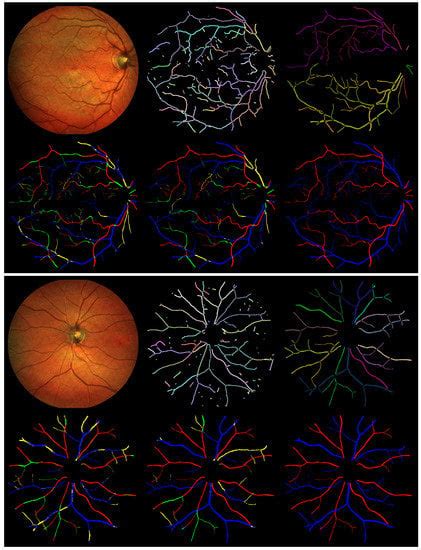 Topology-Aware Retinal Artery–Vein Classification via Deep Vascular ...
