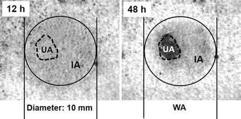 Image result for Deep Tissue Pi