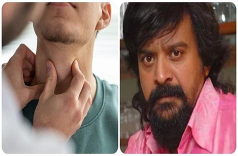 थायरॉइड कैंसर से गई KGF एक्टर की जान, काश पहले ही पहचान लेते इसके ...