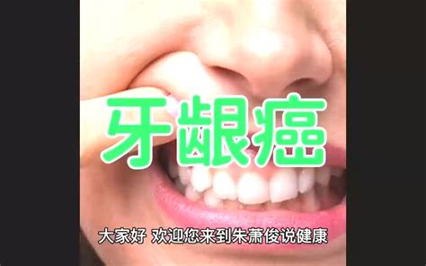【健康养生】经常性牙龈出血是什么原因？_情况