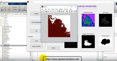 Image result for Skin Disease Detection Using MATLAB