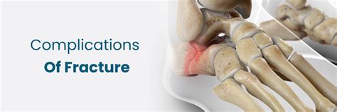 Bone Fracture Complications: Risks and Prevention