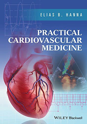 Practical Cardiovascular Medicine eBook : Hanna, Elias B.: Amazon.in ...