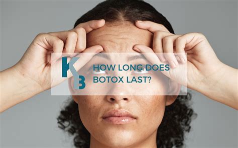 Understanding How Long Anti-Wrinkle or Botox Injections Last