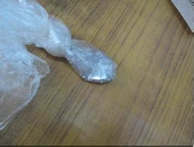 An unusual case of acute mercury poisoning in a neonate | Pediatric ...