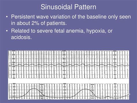 PPT - Basic Fetal Monitoring Review PowerPoint Presentation, free ...