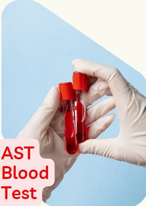 AST Blood Test 的图像结果