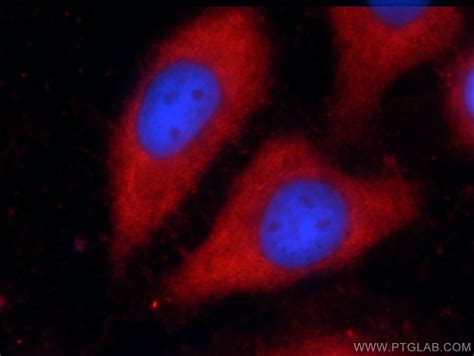 VAMP7/TI-VAMP antibody (22268-1-AP) | Proteintech