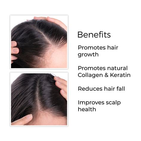 Root Deep Complete Scalp Food For Hair Fall Reduction, Hair ...