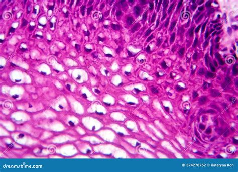 Squamous Epithelial Cells Under Microscope View For Education Hi Stock ...
