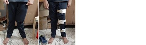 Buy SALO Orthotics Adjustable Knee Genu Valgum Genu Varum Knock Knee ...