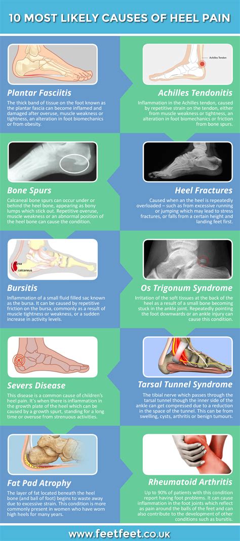 Heel Hurting Causes