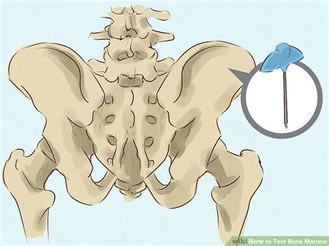 Bone Marrow Testing 的图像结果