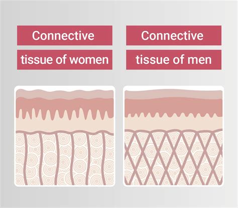 Cellulite Treatment - Dr. Pavicic - Dermatologist Munich