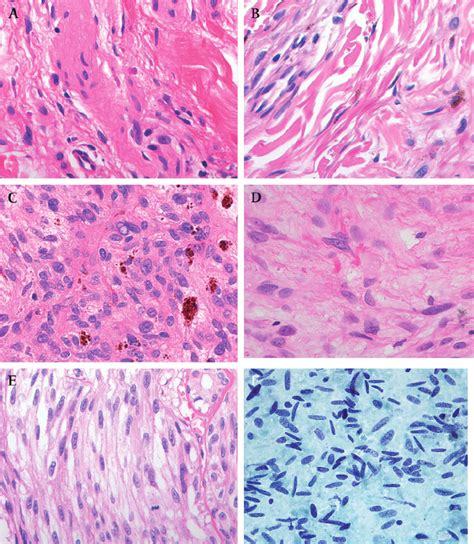 Spindle Shape 的图像结果