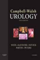CAMPBELL-WALSH UROLOGY, 9/E IE (4 VOL SET) : Amazon.in: Books