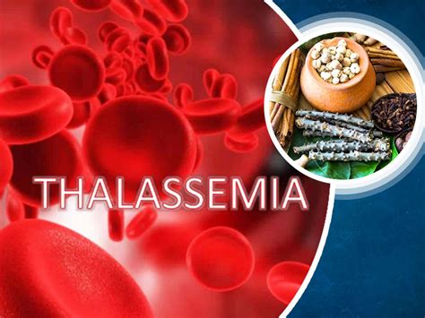 World Thalassemia Day 2021: Ayurvedic Ways to Fight Thalassemia ...