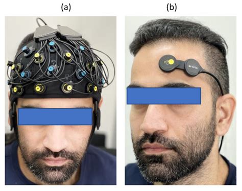 Biosensors | Special Issue : Optical Biosensing and Bioimaging
