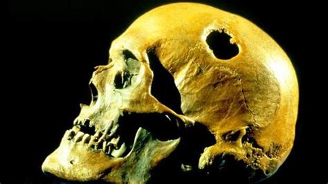 颅骨穿孔术：史前人类为什么要在头骨上钻孔？ - 神秘的地球 科学|自然|地理|探索
