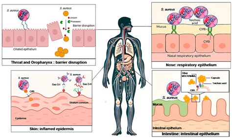 Staphylococcus Aureus Pathogenesis – XCBUBJ