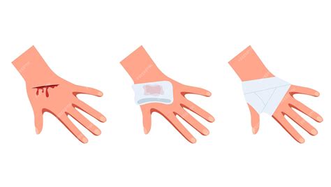Mano con brazo pasos de tratamiento de heridas concepto ilustración de ...