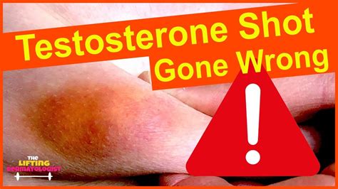 Testosterone Injection Sites 的图像结果
