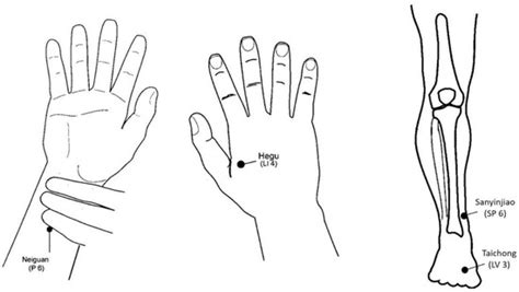 Additional Benefit of Intraoperative Electroacupuncture in Improving ...