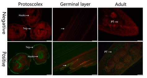 Expression, Tissue Localization and Serodiagnostic Potential of ...