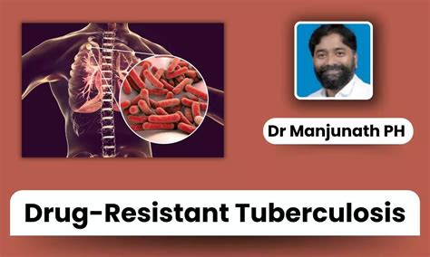 Growing Threat of Drug-Resistant TB: Causes, Challenges & Breakthrough ...