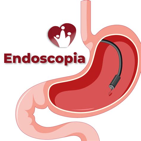 Endoscopia Tumbaco 365 días del año.