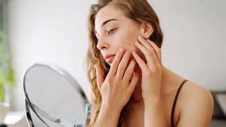 Winter Dandruff And Hair Fall Explained: Doctor Explains How Cold ...