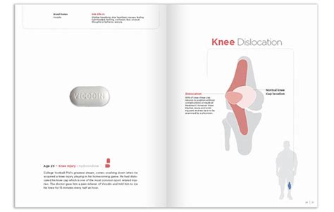 Image result for Remedy Tutorial