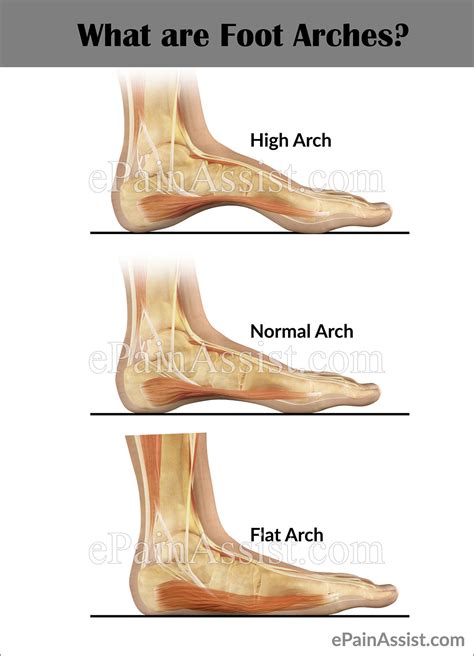 Foot Pain Arch