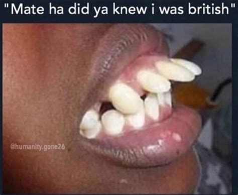 🤦‍♂️ British people don't actually have bad teeth : r/facepalm
