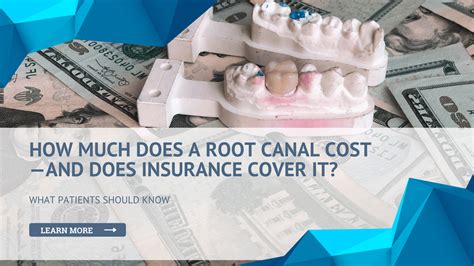 How Much Does a Root Canal Cost? Insurance & Pricing Explained