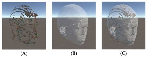 Augmented Reality Navigation for Acupuncture Procedures with Smart Glasses
