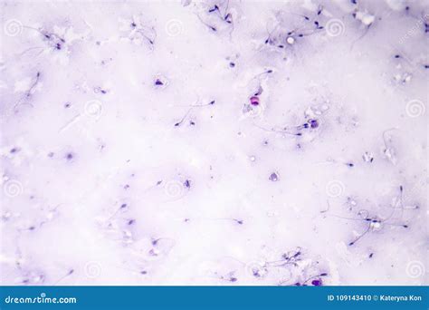 Sperm Morphology. Semen Photo Under Microscope | CartoonDealer.com ...