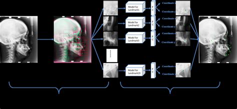 Advanced Two by Two Method 的图像结果