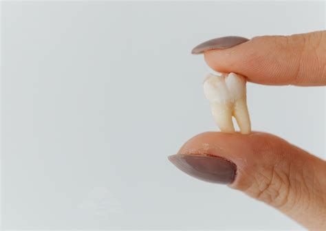 Loose Tooth - Duthie Dental